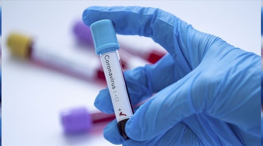 Vaka say�s� 5 binin alt�na inmiyor