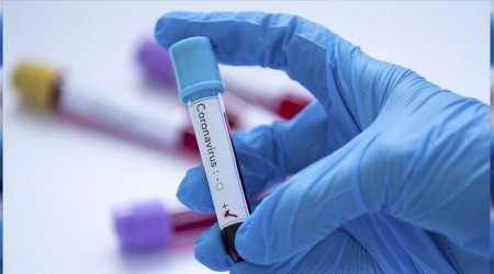 Vaka say�s� 5 binin alt�na inmiyor