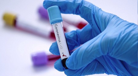 Vaka say�s� 12 bini ge�ti