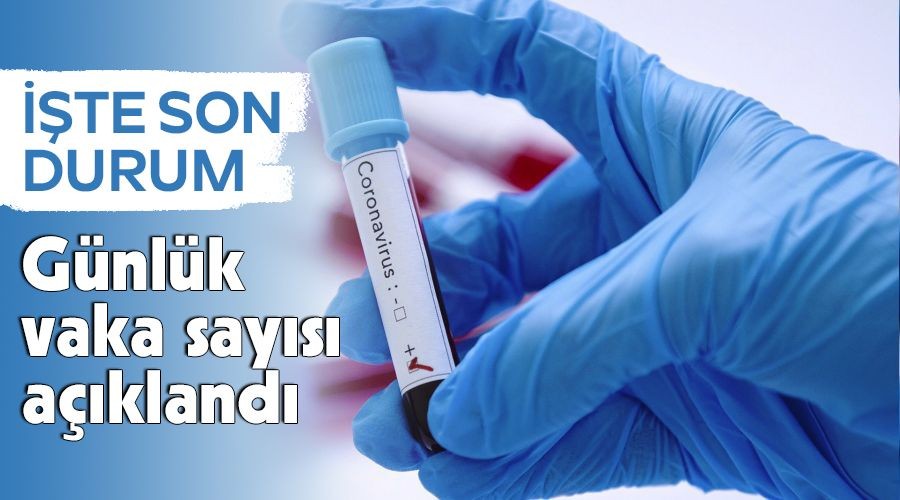     Son 24 saatte 231 ki�i vefat etti