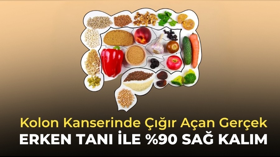 Erken Tan� ile %90 Sa� Kal�m: Kolon Kanserinde ����r A�an Ger�ek