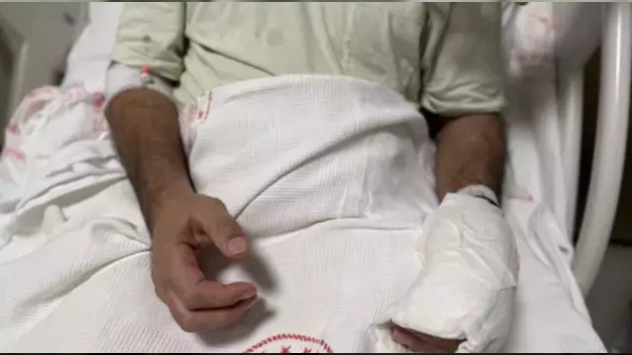 Herkesin Evindeki Tehlike! Vücudunun Yüzde 30'u Yandı