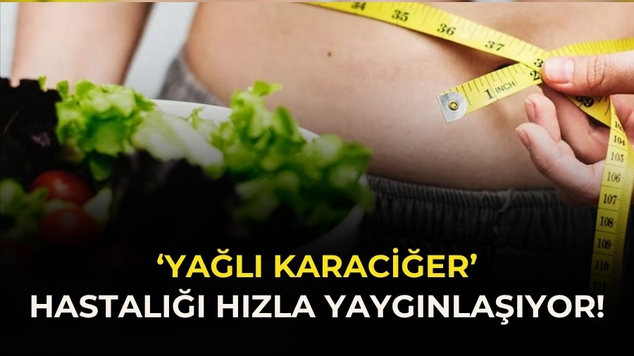 �Ya�l� karaci�er� hastal��� h�zla yayg�nla��yor!