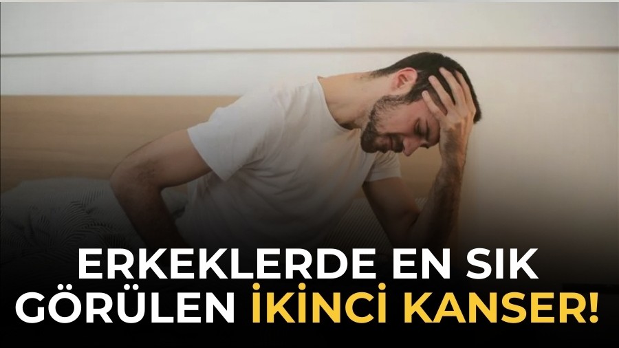 Erkeklerde en s�k g�r�len ikinci kanser!